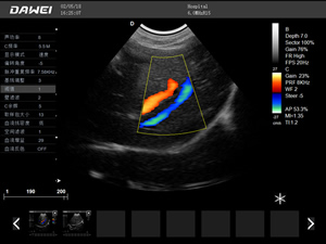 S8便攜筆記本獸用彩超機(jī)-寵物b超機(jī)掃描圖